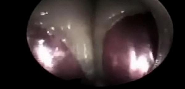  Video internal vagina
